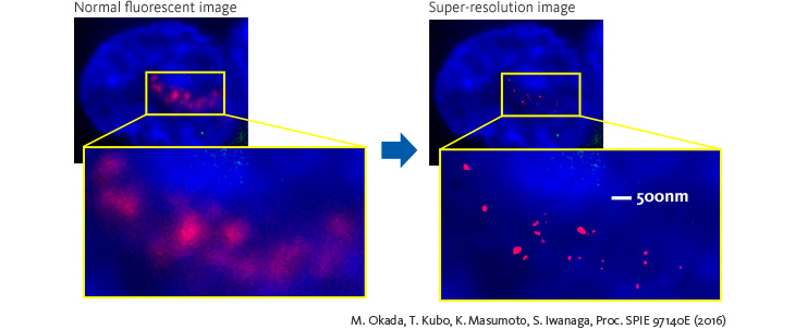 Application to cancer cell strain