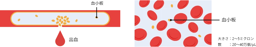 血小板の役割を示す図。傷ついた血管からの出血と、血小板が集まって固まり傷口をふさごうとしている様子が描かれている。右側には血小板の拡大図があり、血小板の大きさ（2〜5ミクロン）と、体内に存在する数の目安（20〜40万個/μL）が記載されている。