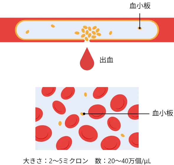 血小板の役割を示す図。傷ついた血管からの出血と、血小板が集まって固まり傷口をふさごうとしている様子が描かれている。右側には血小板の拡大図があり、血小板の大きさ（2〜5ミクロン）と、体内に存在する数の目安（20〜40万個/μL）が記載されている。