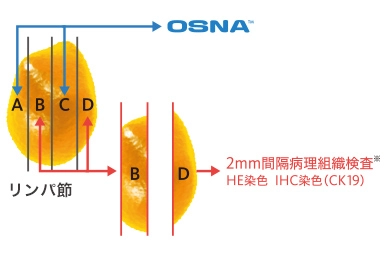 乳がんリンパ節転移検査に関するデータ3