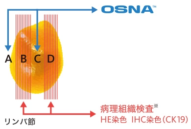 大腸がんリンパ節転移検査に関するデータ1
