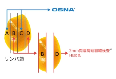 大腸がんリンパ節転移検査に関するデータ2