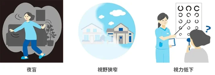 IRD患者さんの主な症状